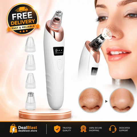 5-in-1 Electric Blackhead Remover Vacuum – Deep Pore Cleaner